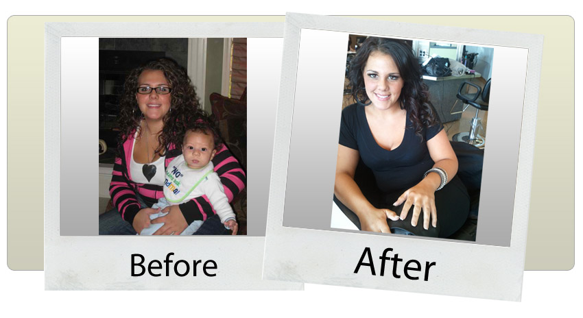 hcg diet hcg diet before after photos